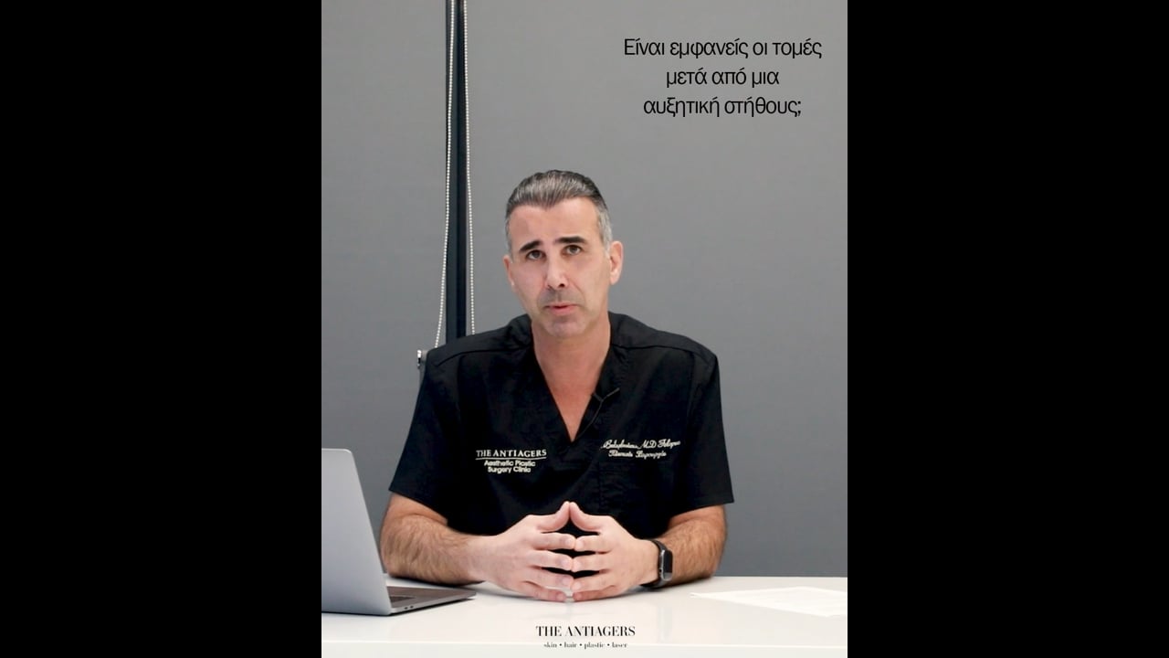 Αυξητική στήθους: Θα είναι εμφανείς οι τομές της επέμβασης;