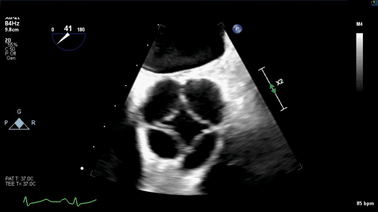 Cardiac and Vascular Imaging - Cardiac - Western University