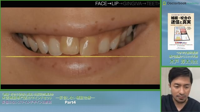 #4 前歯部のポジショニングの基準