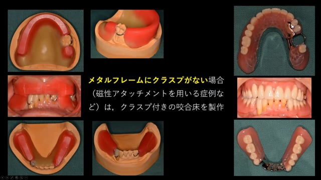 #3 Denture Cafe 第27回 トークセッション