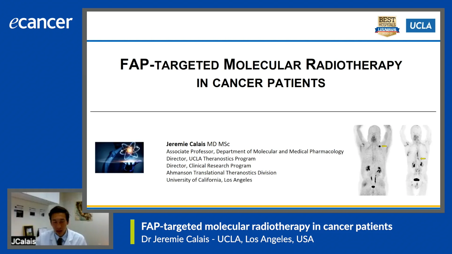 FAP-targeted molecular radiotherapy in cancer patients