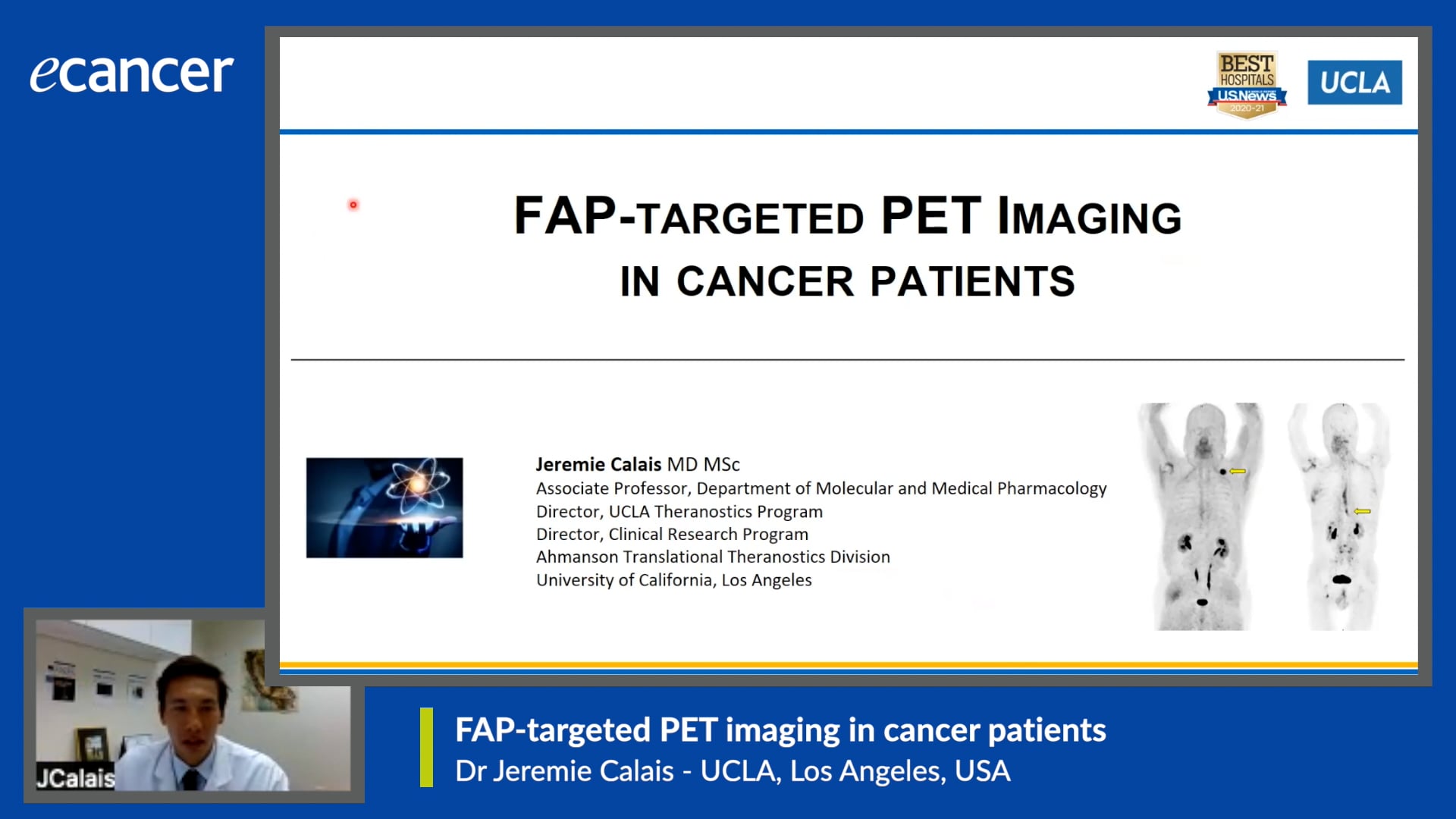 FAP-targeted PET imaging in cancer patients