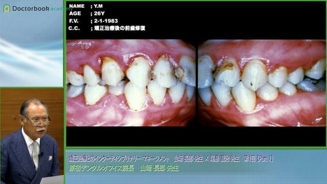 審美補綴治療における矯正治療の重要性 / 山﨑長郎先生 #1