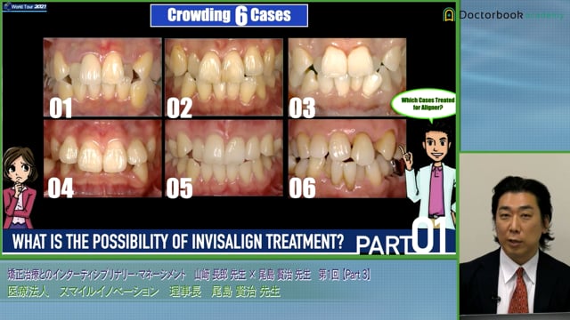 アライナー矯正治療・インビザラインとは何か / 尾島賢治先生 #3 