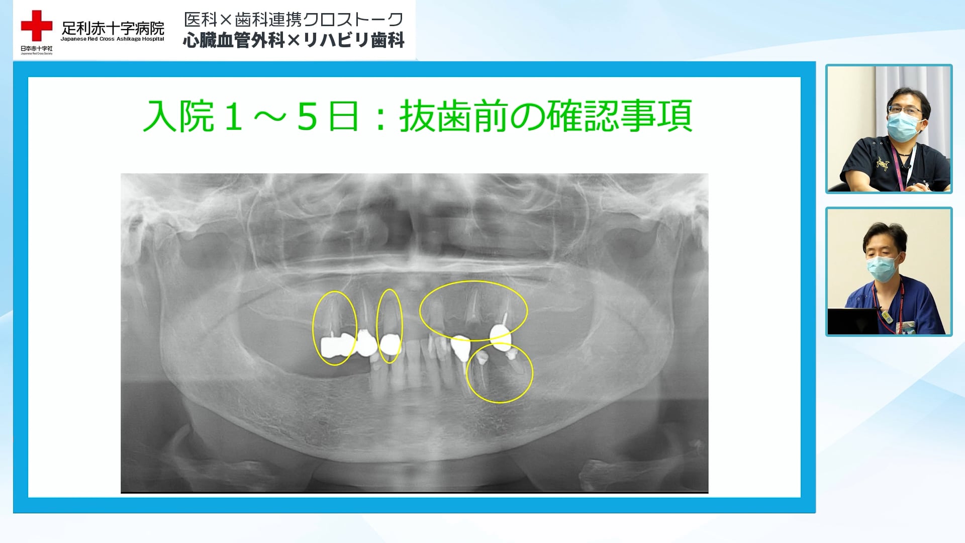 歯科・医科の保険収載事項比較 心臓血管外科手術での口腔機能管理料と稼働額