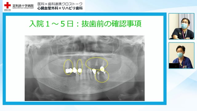 医科×歯科連携 クロストーク 心臓血管外科×リハビリ歯科　Part3