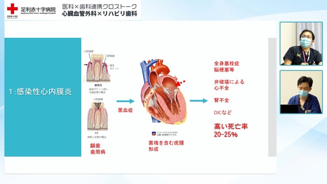 医科×歯科連携 クロストーク 心臓血管外科×リハビリ歯科　Part2