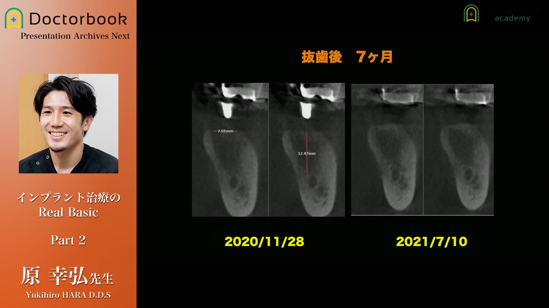 CT画像から読み取るべき情報