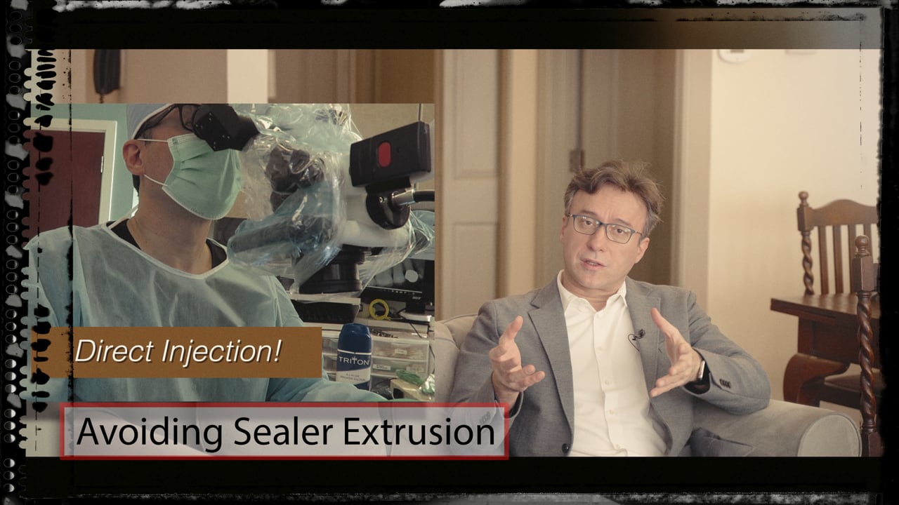 Prevention of Sealer Extrusion (Q&A) Real World Endo Endodontics