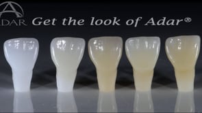All-on-X and Full Mouth Cases with or without Optional Sintering Support, Ft. Ardar - Part 2