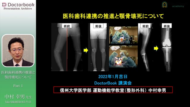 歯周病と骨粗鬆症の関係