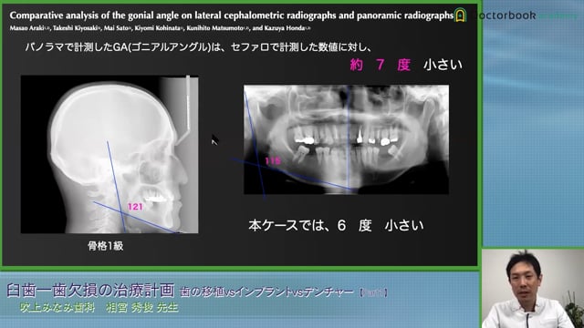 現代の臨床補綴 : 歯周治療をふまえた補綴・インプラント治療-