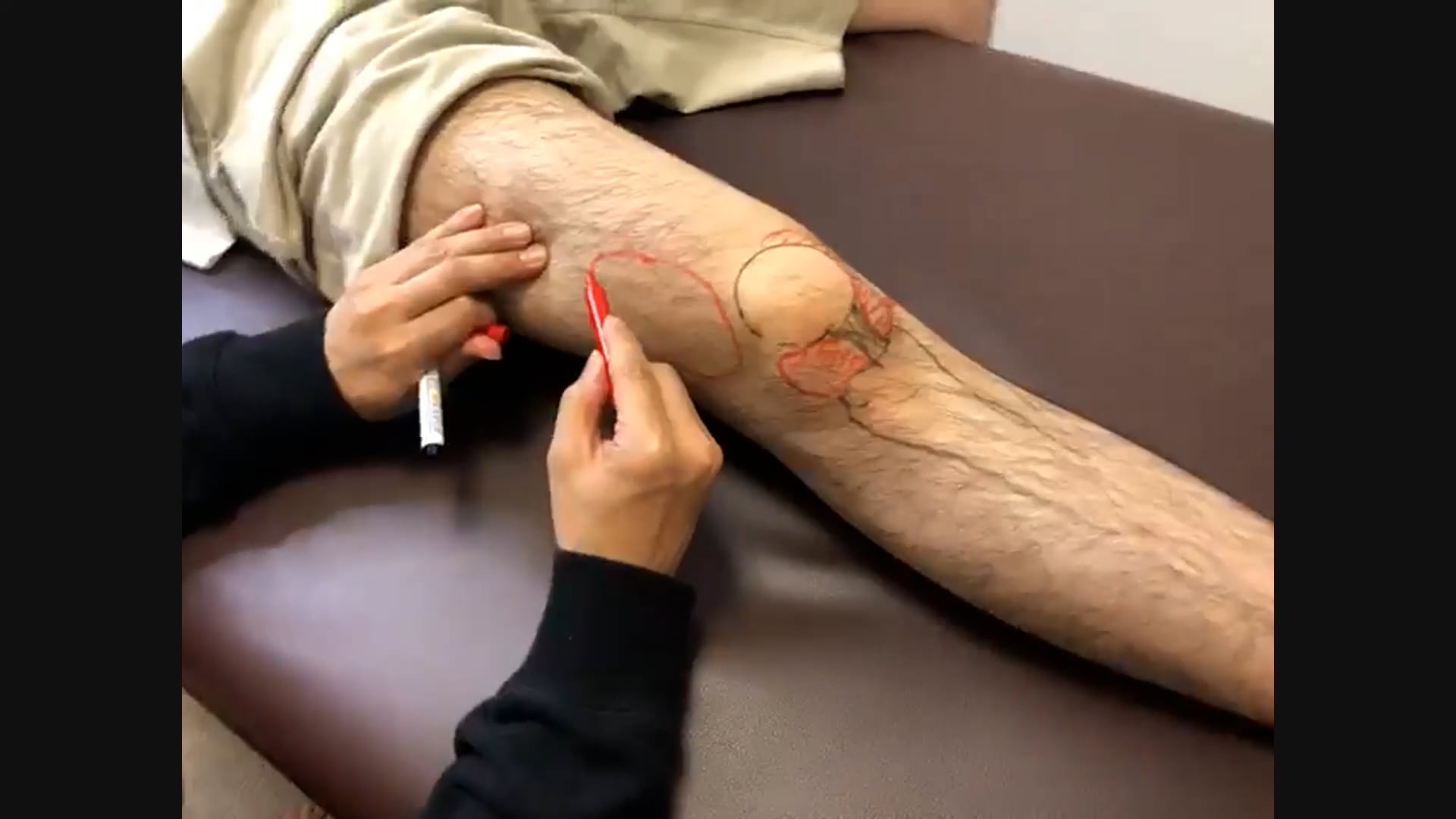 オンライン実技講習：膝関節の治療　Part1・基礎編