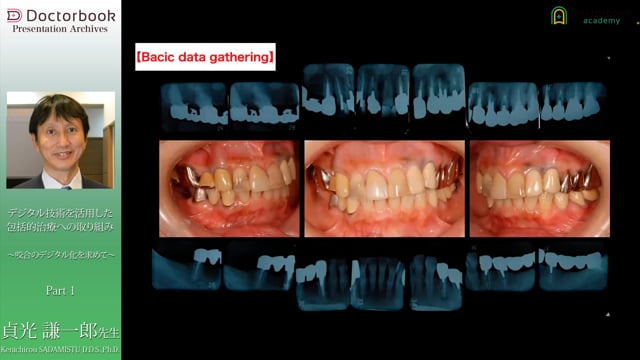 デジタル技術を活用した包括的治療への取り組み 〜咬合のデジタル化を 