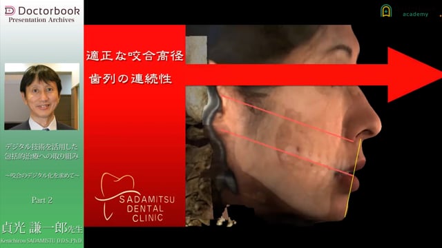 CTと口腔内スキャナー・CADを用いた咬合設定と治療について