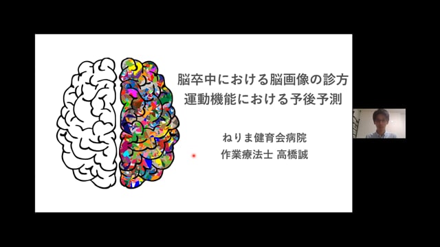 脳卒中における脳画像の診方～運動機能における予後予測～