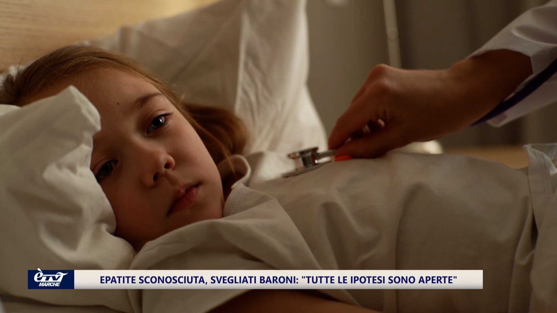 Epatite acuta pediatrica: i segnali da monitorare - VIDEO