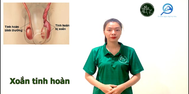 xoan-tinh-hoan-7755