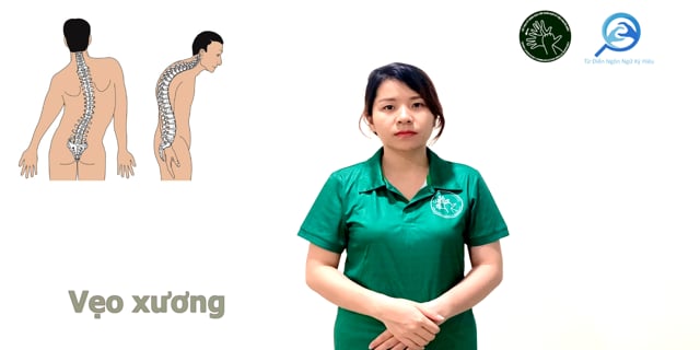 veo-xuong-7737