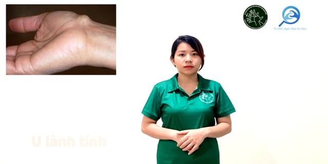 u-lanh-tinh-7733
