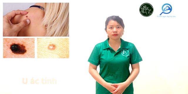 u-ac-tinh-7732