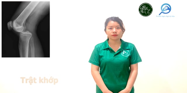 trat-khop-7724