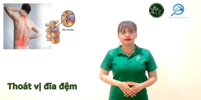 thoai-vi-dia-dem-7705