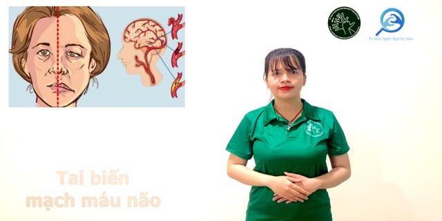 tai-bien-mach-mau-nao-7688