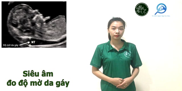 sieu-am-do-mo-gay-7678