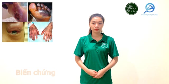 bien-chung-7525