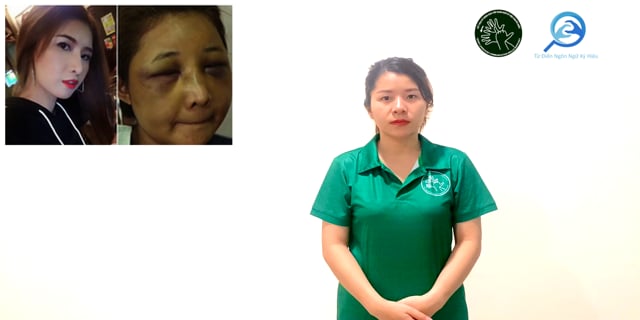 bien-dang-7526