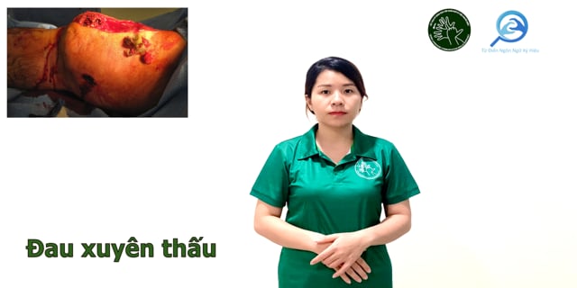 dau-xuyen-thau-7568