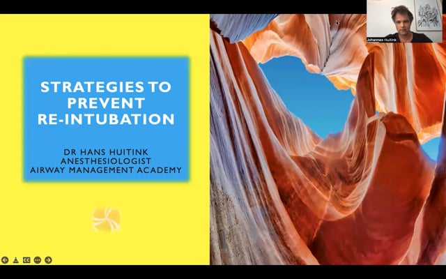 Extubation