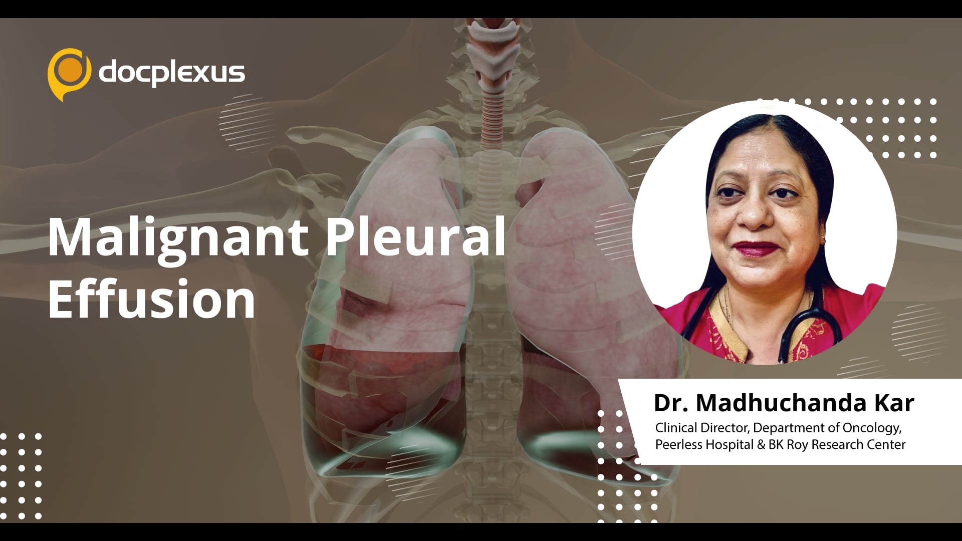 Malignant Pleural Effusion