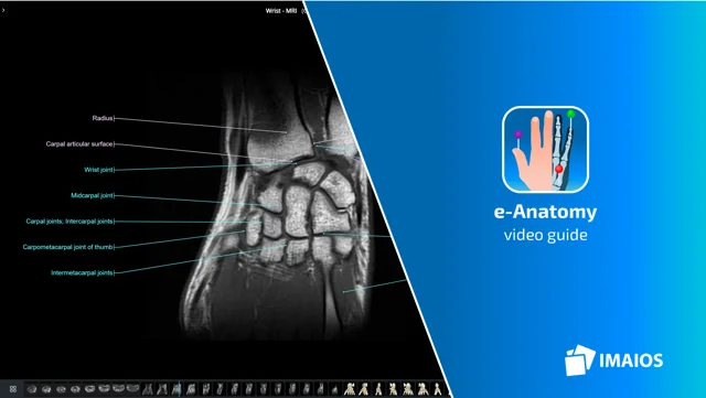 Stapes - e-Anatomy - IMAIOS