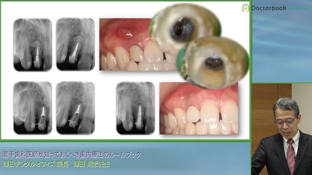 若手歯科医師が知っておくべき歯内療法のルールブック
