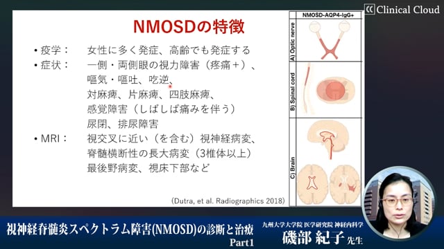 視神経脊髄炎スペクトラム障害（NMOSD）の診断と診療 Part1
