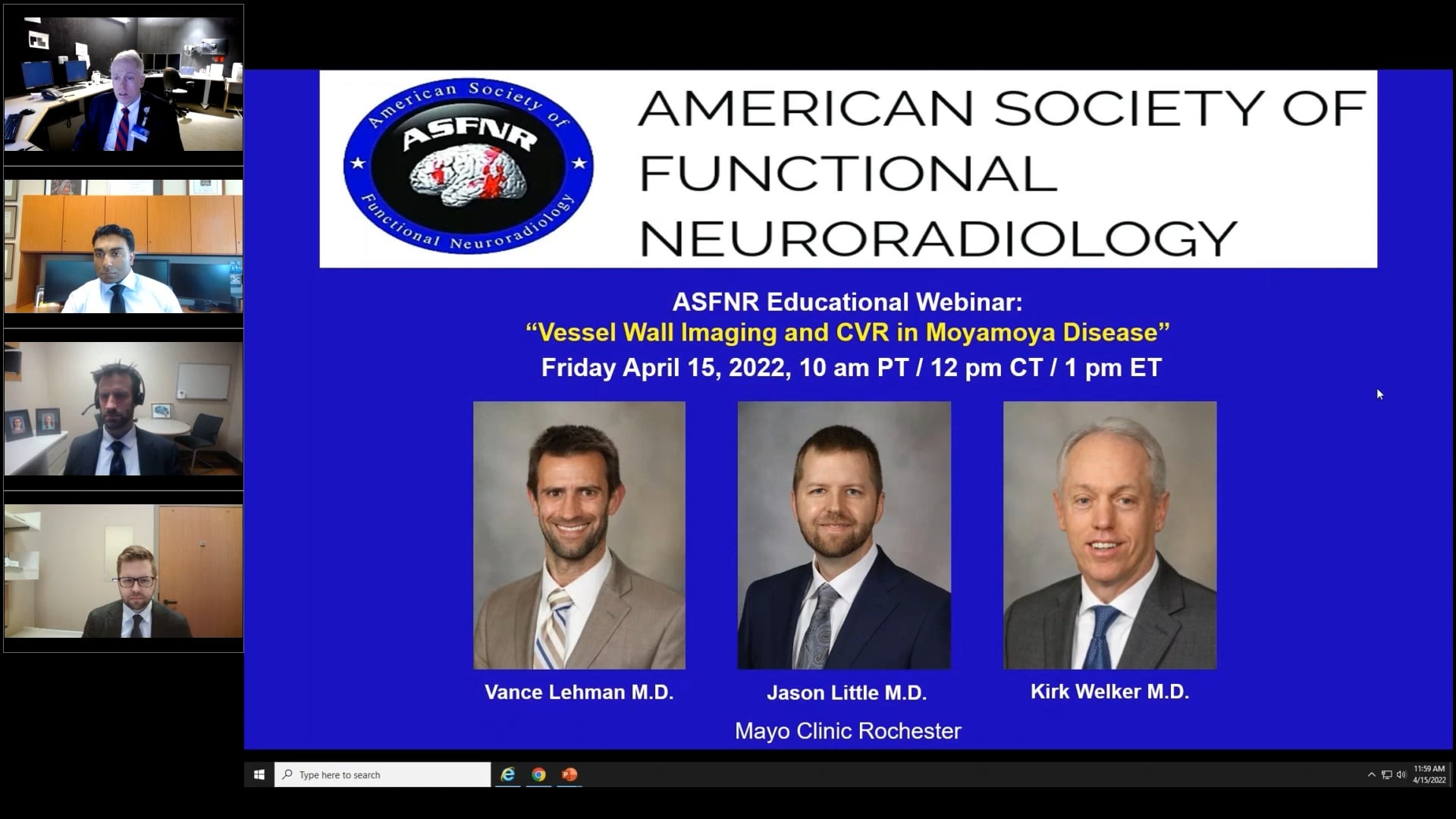 CVR and VWI Moyamoya Disease 4.15.22