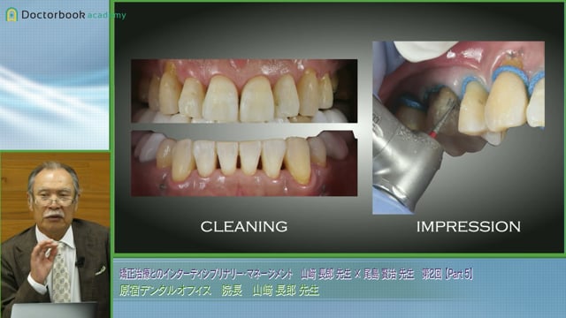 Morphological Tooth Augmentation Procedure（MTAP）の理論と実際│山﨑長郎先生 #5