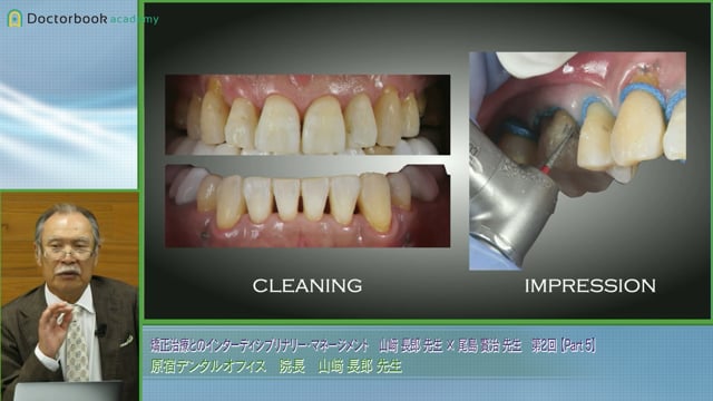 Morphological Tooth Augmentation Procedure（MTAP）の理論と実際│山﨑長郎先生 #5