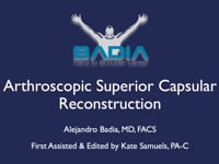 Reconstrucción capsular superior artroscópica para una rotura irreparable del manguito rotador