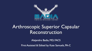Arthroscopic superior capsular reconstruction for an irreparable rotator cuff tear