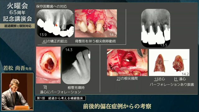 前後的偏在症例からの考察│若松 尚吾先生