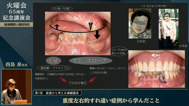 重度左右的すれ違い症例から学んだこと│西島 泉先生