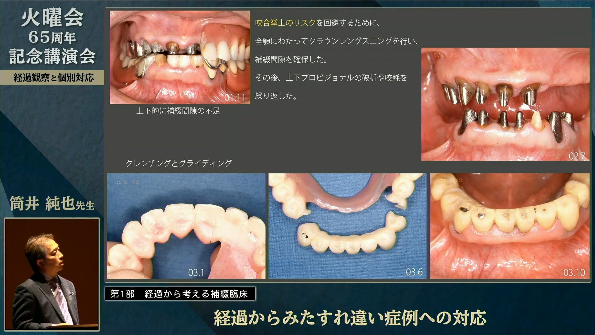 経過からみたすれ違い症例への対応│筒井 純也先生