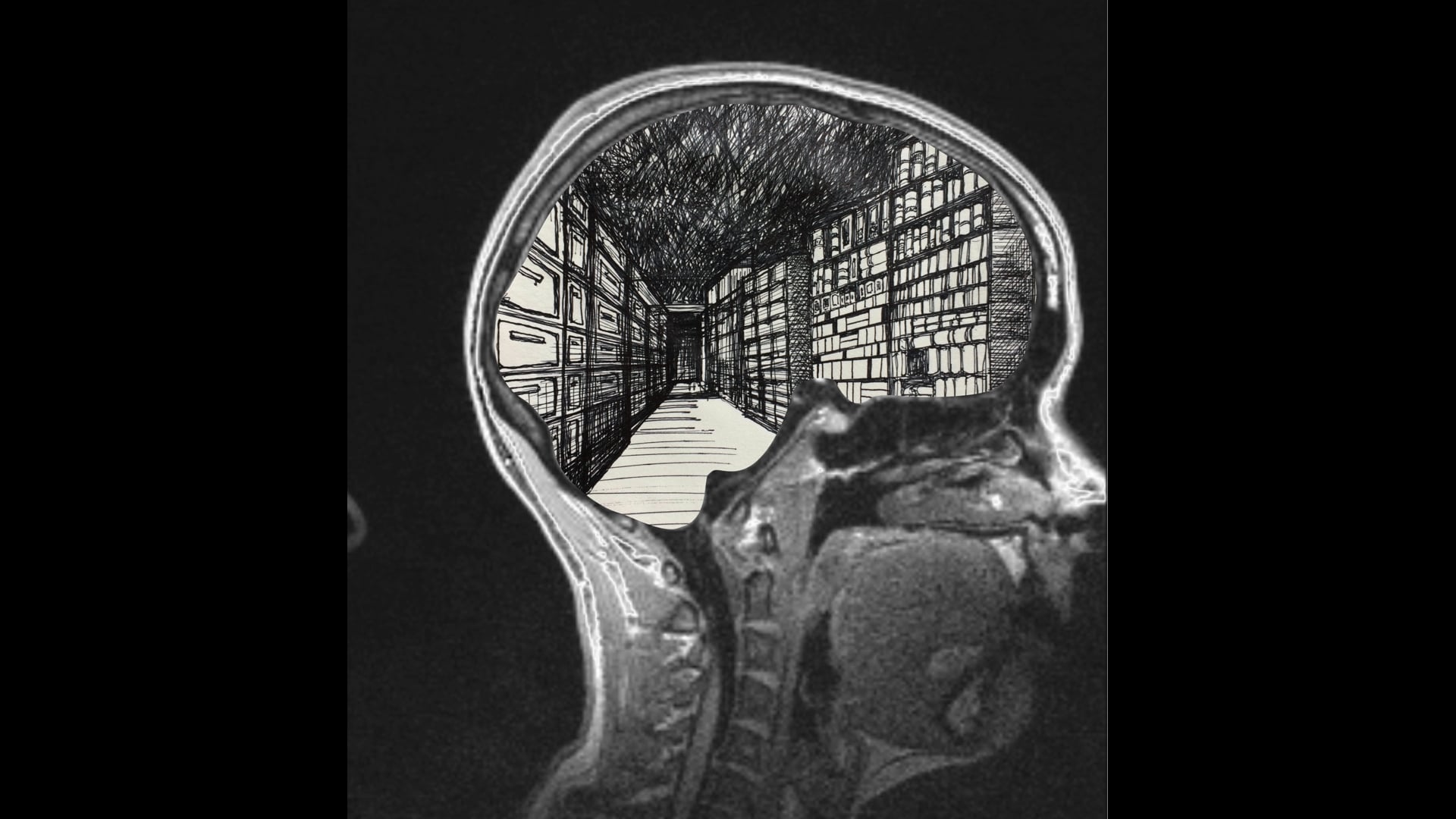 Brain Landscapes