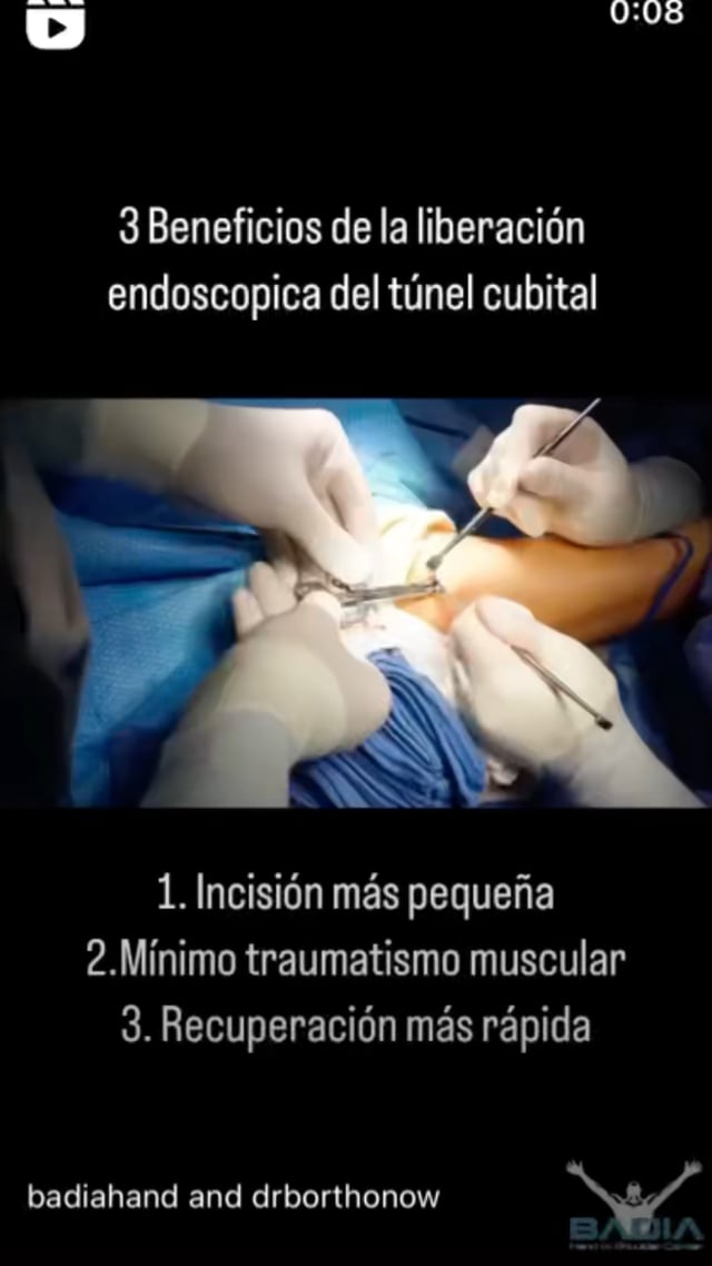 Benefits of Endoscopic Release: A Minimally Invasive Procedure for Elbow Pain