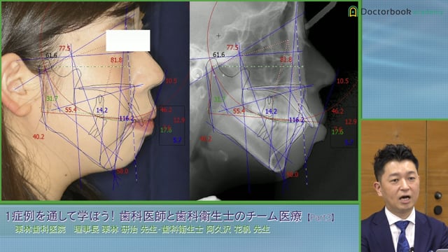 診療内容シートとアシスト事前準備シートの活用 / MTF治療での歯科衛生士の役割 #3