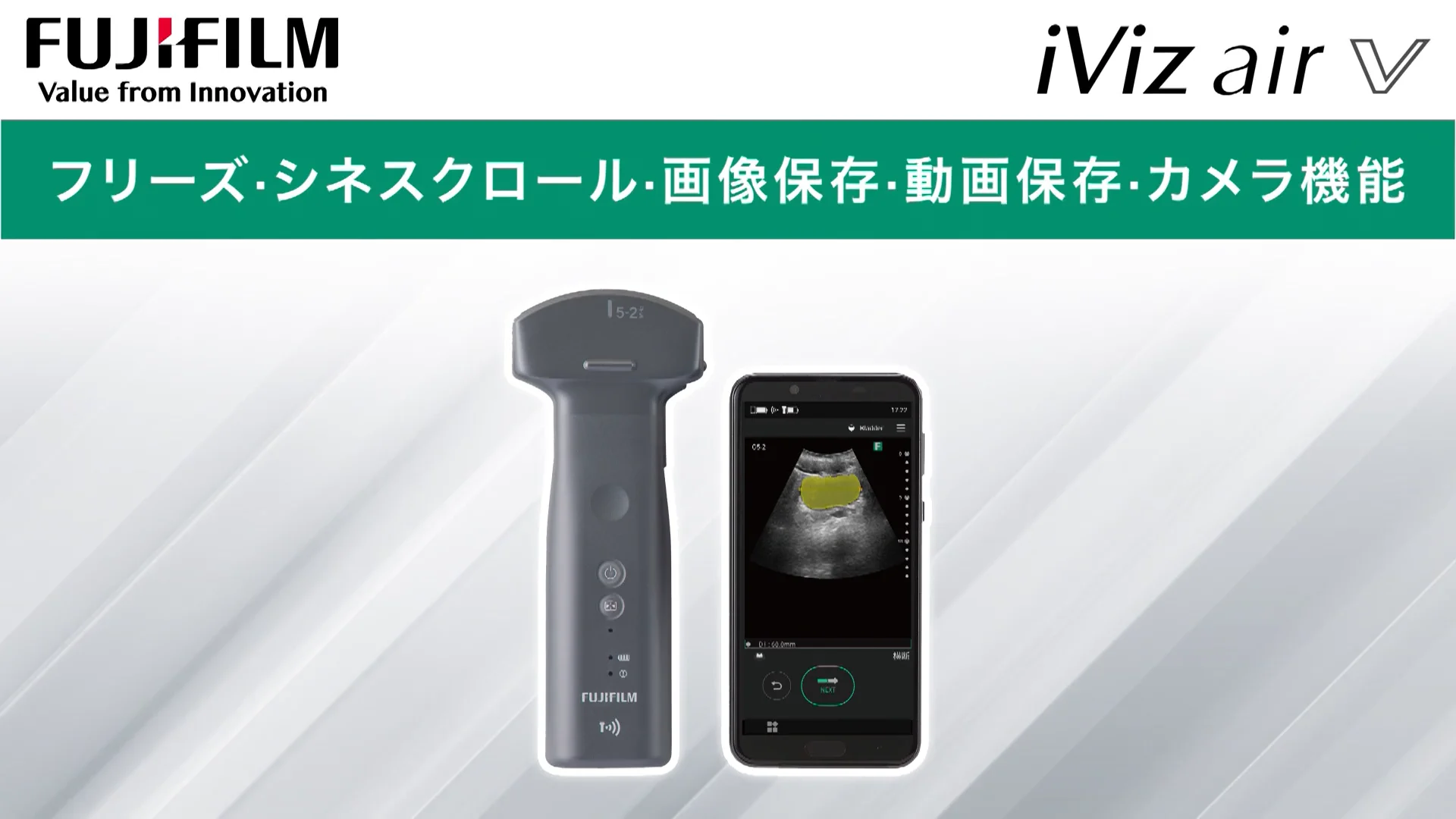 ENRIKE 複合機　ハイフ超音波・フォトフェイシャル・キャビラジ　動作確認済み 超音波診断装置｜富士フイルムヘルスケア｜ARIETTA 65LE｜中古医療機器