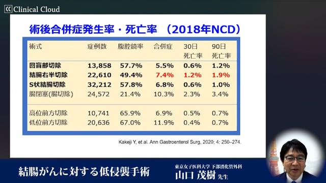 結腸がんに対する低侵襲手術 Part2